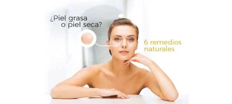 remedios para la piel grasa